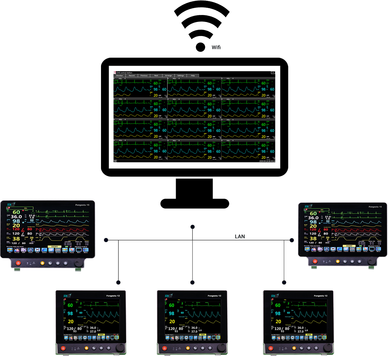 CENTRAL MONITORING SYSTEM &#40;CMS&#41;